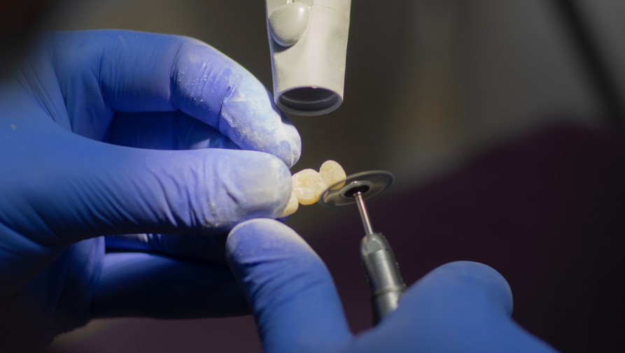 Újgenerációs fogászati implantátum-rendszert fejlesztett az SZTE és a Denti System Kft.